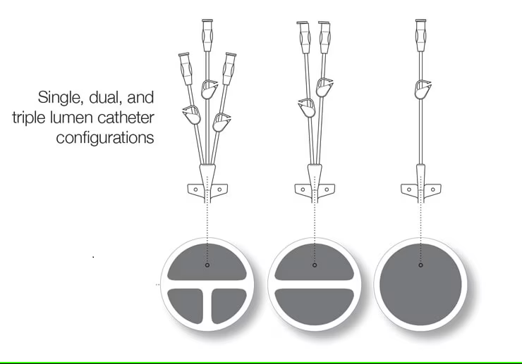 Illustration showing single, dual, and triple lumen catheter configurations