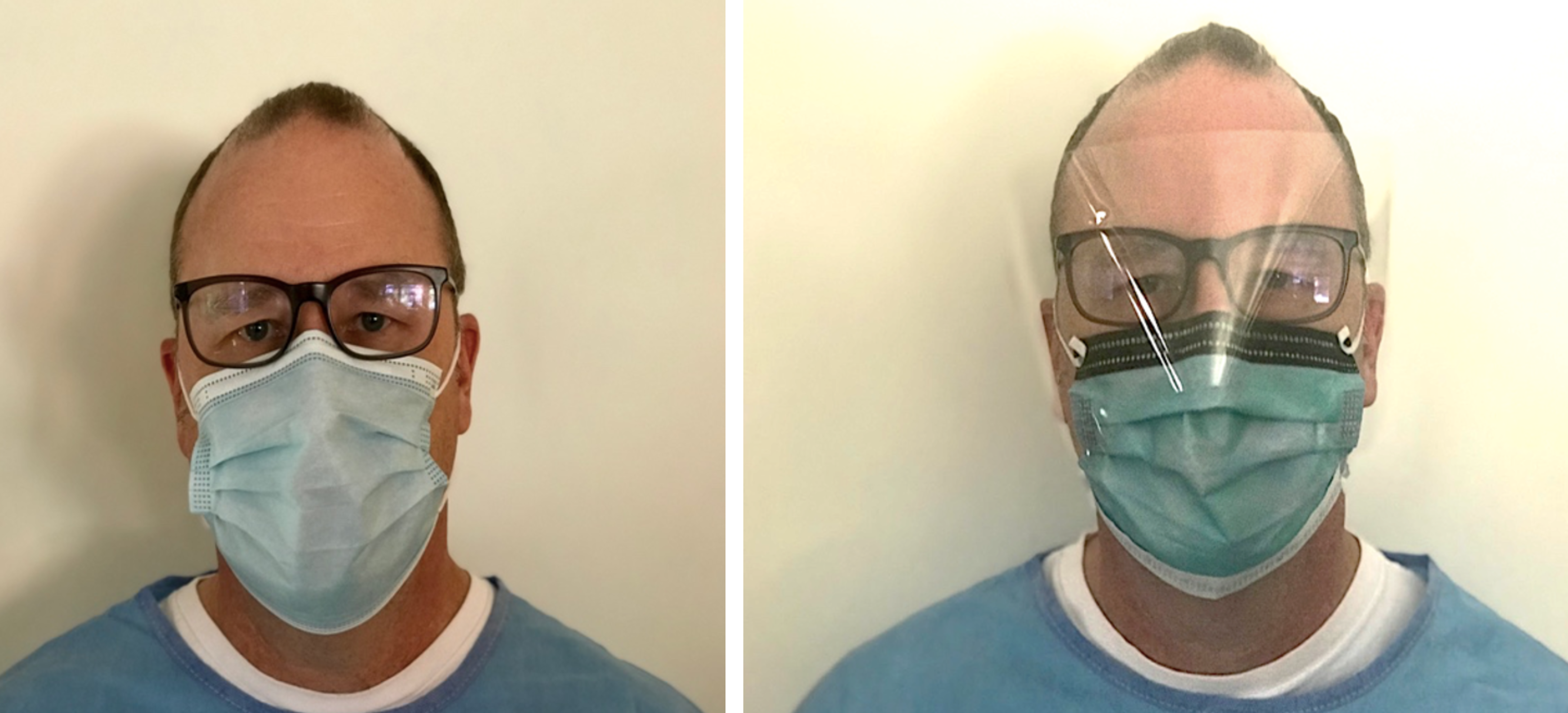 Photos showing a healthcare worker wearing a medical mask both with and without an eye shield