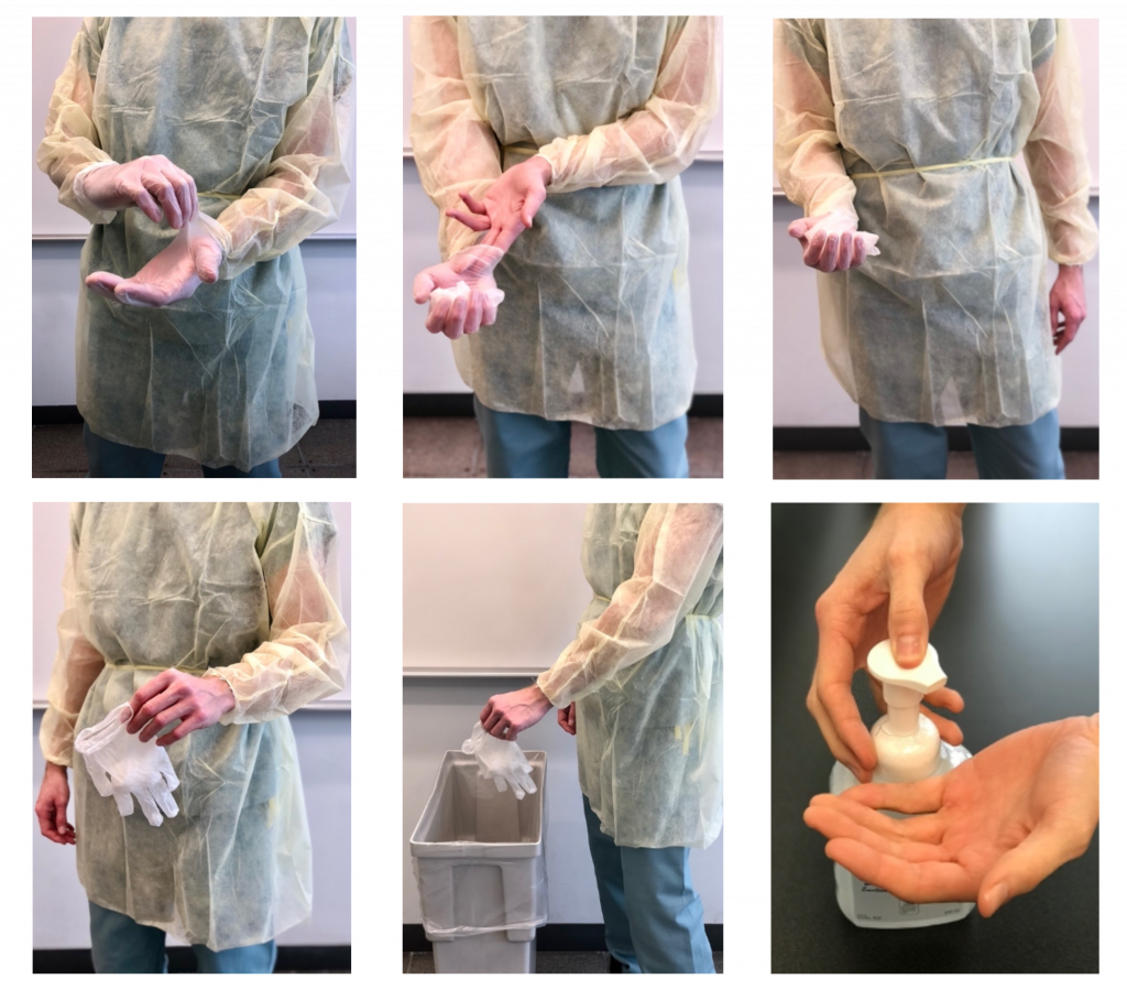 Six photos showing steps for glove removal