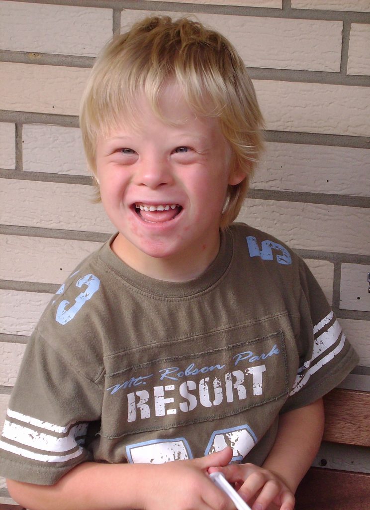 Photos of a School-Aged Child With Down Syndrome