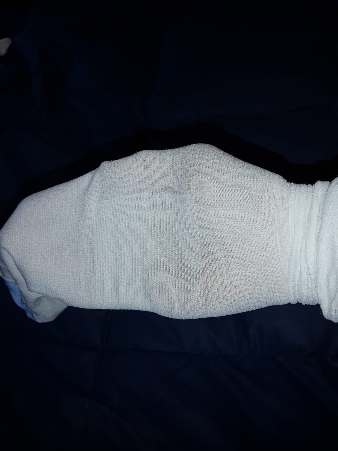 9.4 Complications of Immobility Nursing Assistant