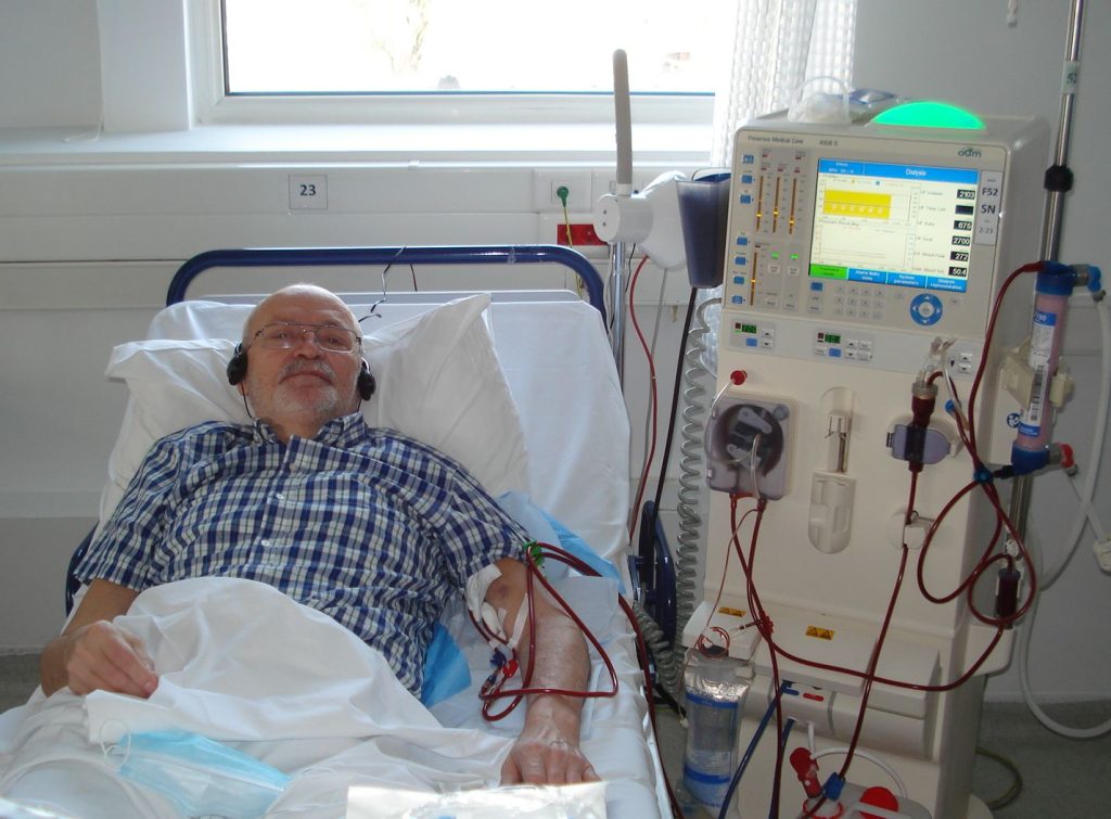 Image showing a patient undergoing hemodialysis