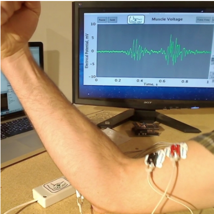 Image showing Electromyography on a patient's bicep