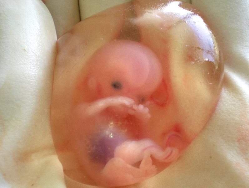 Image showing a 10 week old human fetus