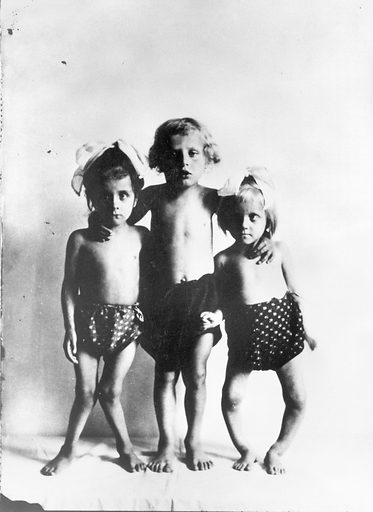 Image showing three children with bow legging from rickets