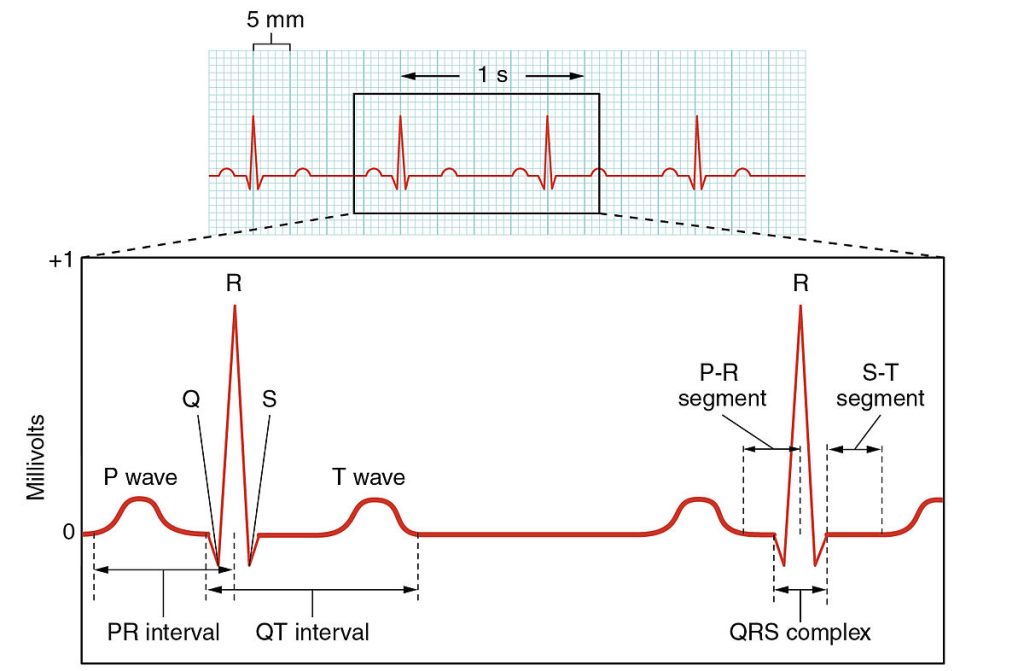 Image showing components of an ECG reading
