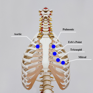 Image showing major precordial areas, with labels