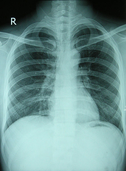 Image showing a chest x-ray