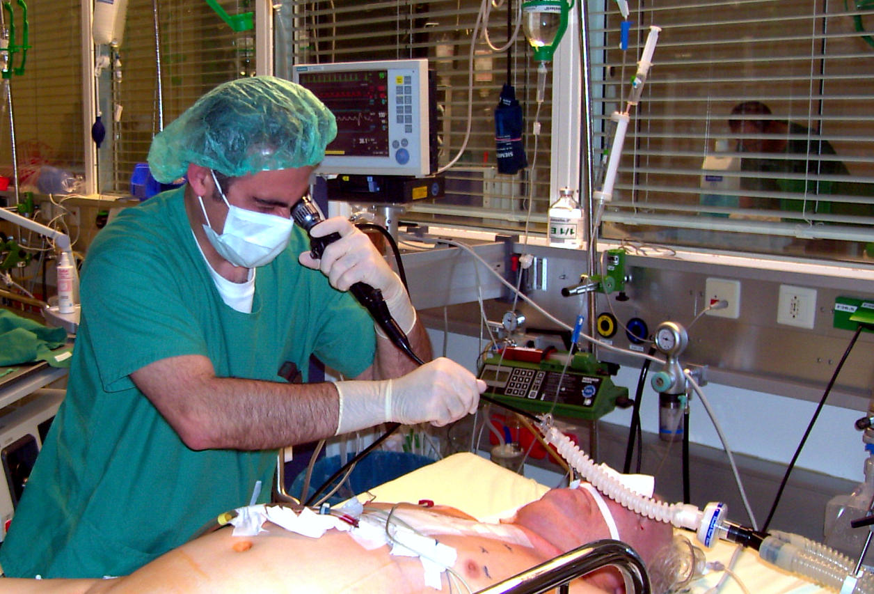 Image showing a patient undergoing a bronchoscopy