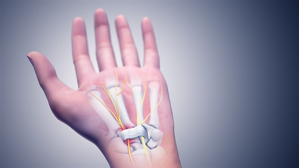 Illustration showing the bones, tendons and nerves inside the hand and wrist impacted by Carpal Tunnel Syndrome