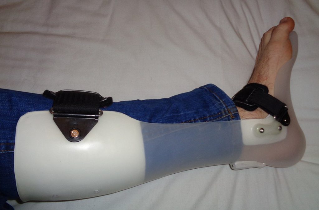 Image showing foot drop being treated with a leg brace