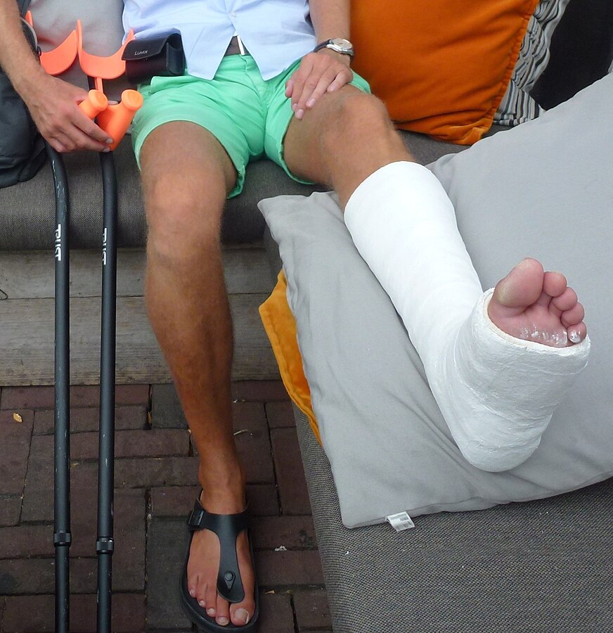 Image showing a person with a case on their lower leg and foot