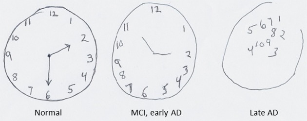 Image showing Example of a Clock Drawing Test