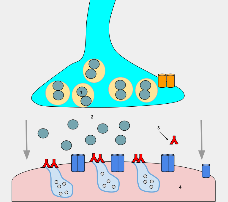 Illustration showing Antibody Binding to ACh Receptor Sites Causing Myasthenia Gravis
