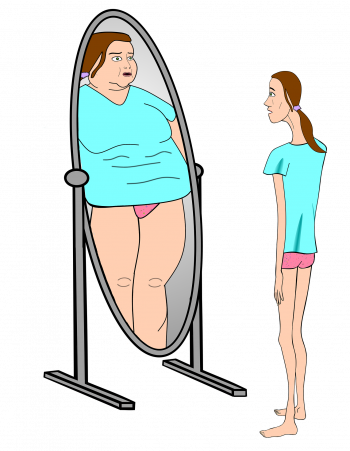 Illustration of Typical Body Perception by a Person With Anorexia Nervosa