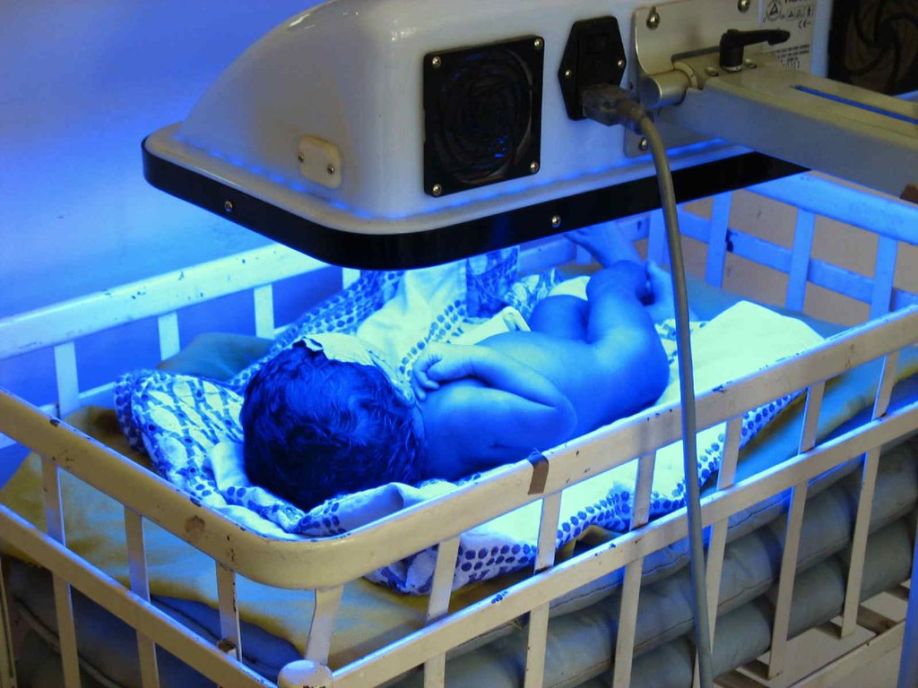 Photo showing a newborn receiving phototherapy for jaundice