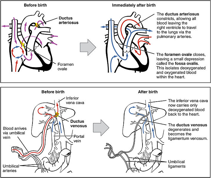 Illustration showing changes in the neonatal circulation from before and after birth