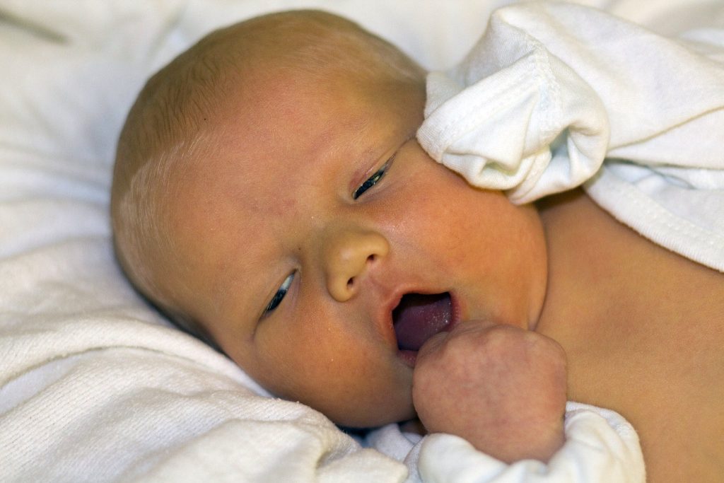 Photo showing a newborn with open mouth and slightly yellow skin