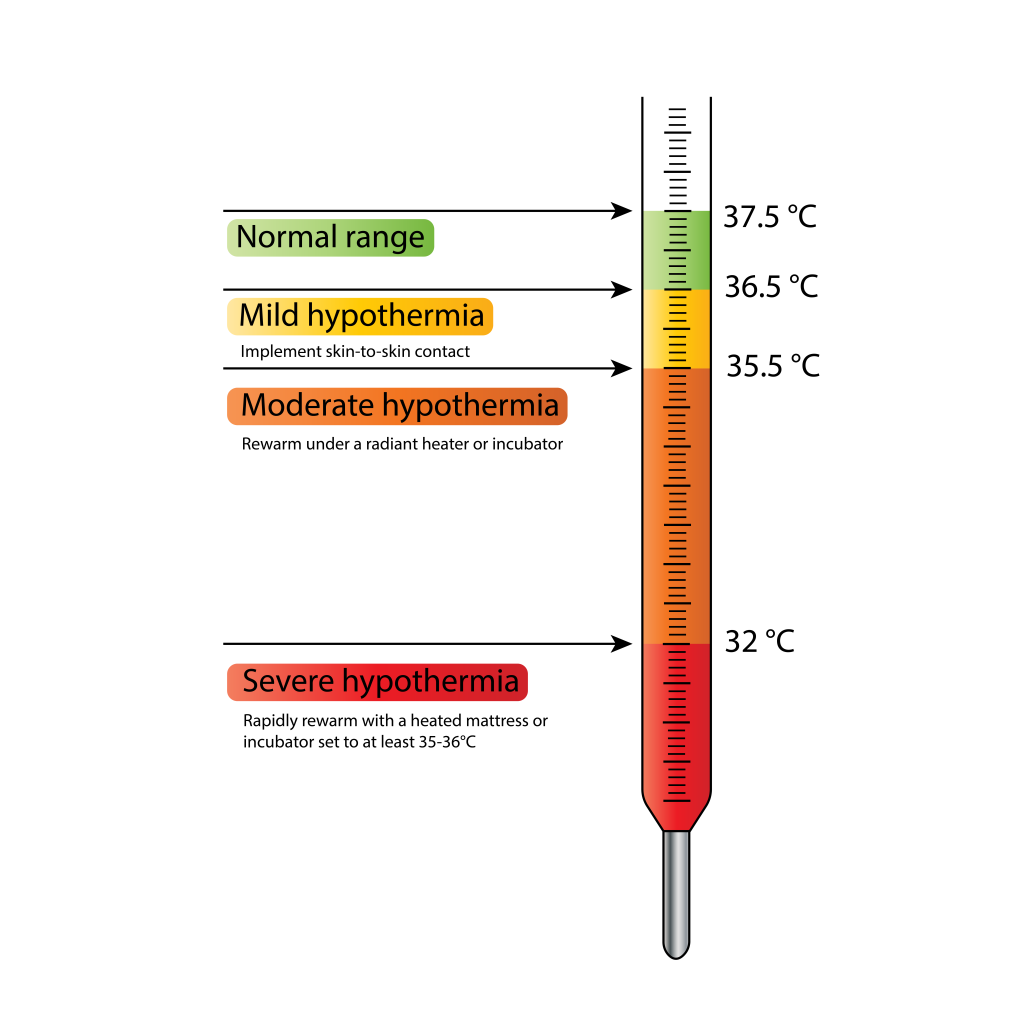 Illustration showing a thermometer with text labels to indicate different neonatal temperature ranges