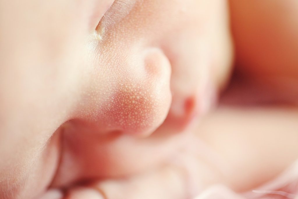 Photo showing a closeup of milia on a newborn's face