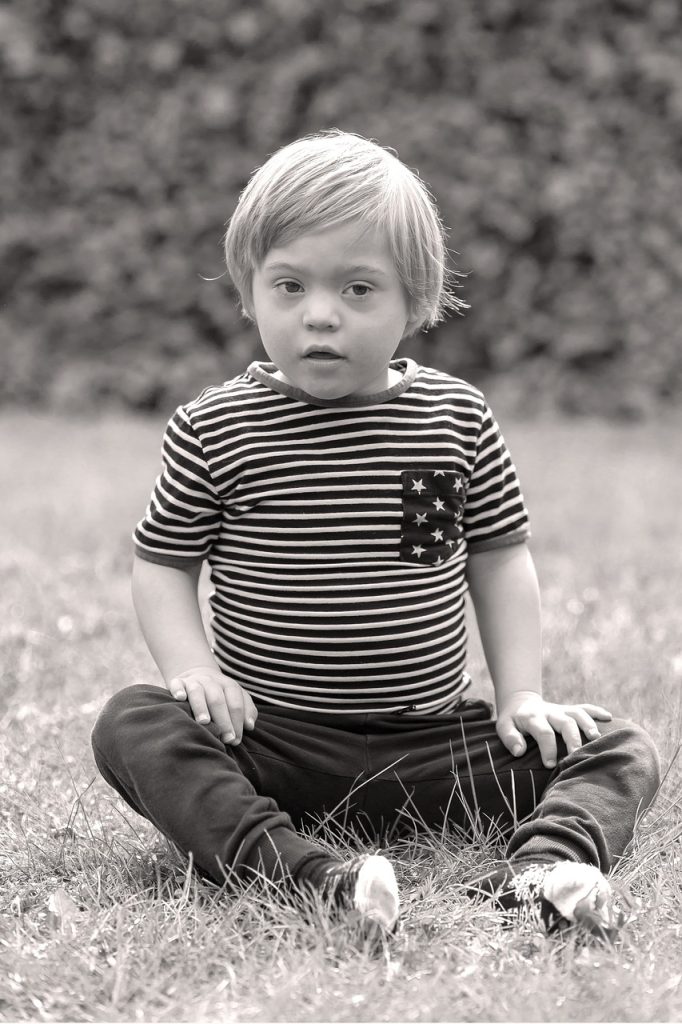 Photo showing a child with down's syndrome