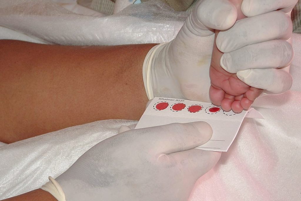 Photo showing the collection of newborn screening samples from a child's foot