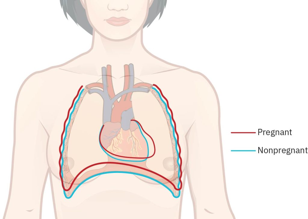 Illustration showing heart and diaphragm displacement during pregnancy