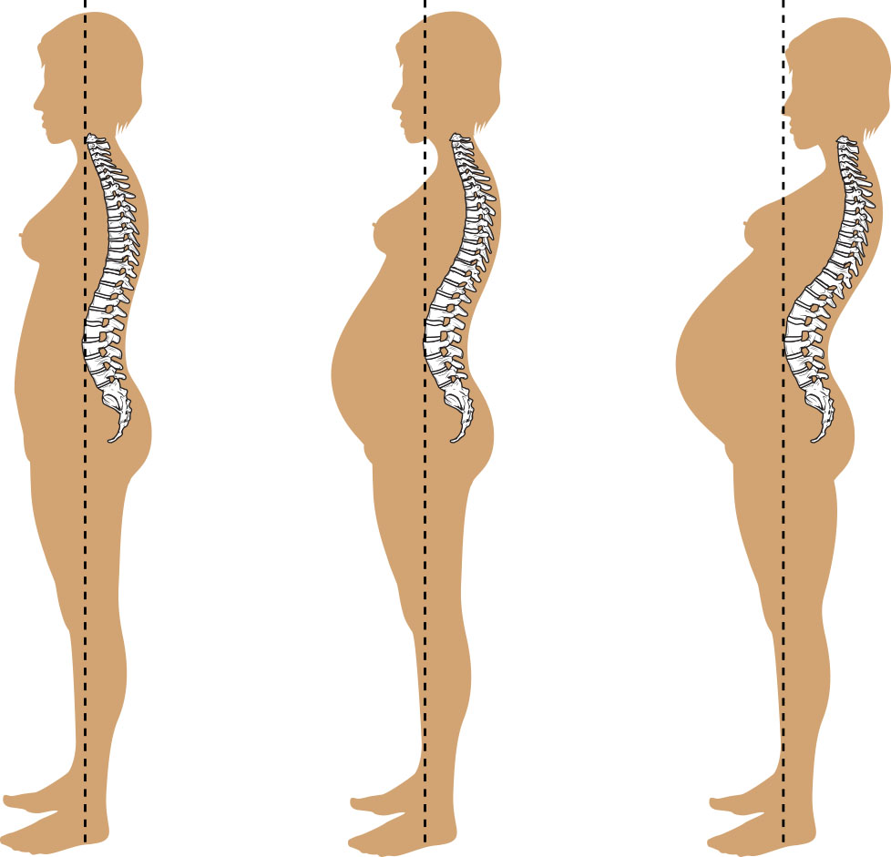 Illustration showing lordosis during pregnancy