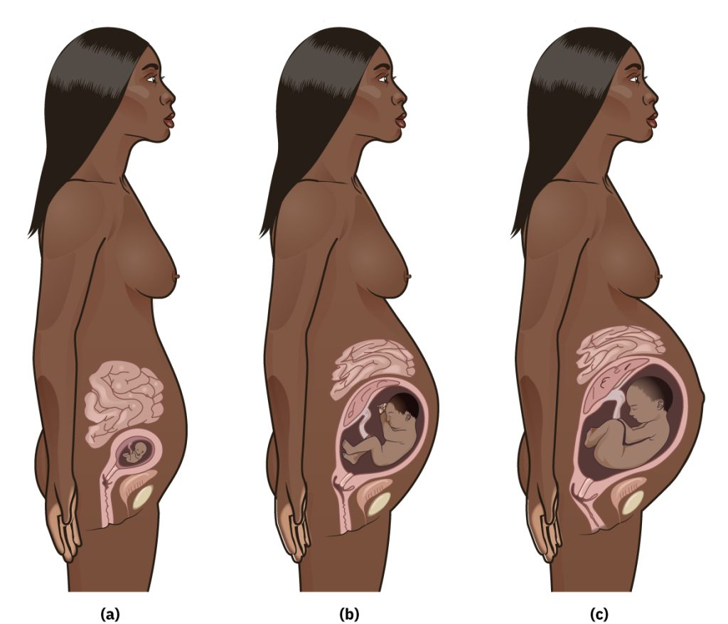 Illustration showing the Displacement of the Intestines During Pregnancy