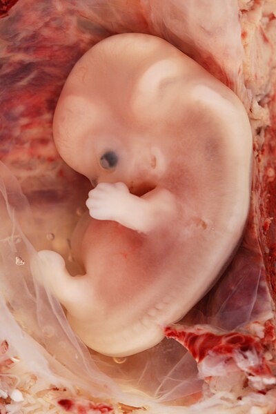 Photo showing a closeup of a nine week human embryo