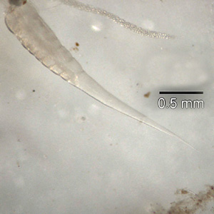 Photo showing a closeup of the pointed tail of a pinworm