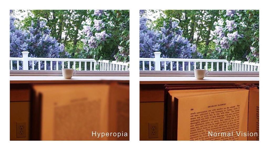 Photos comparing blurred vision in hyperopia and normal vision