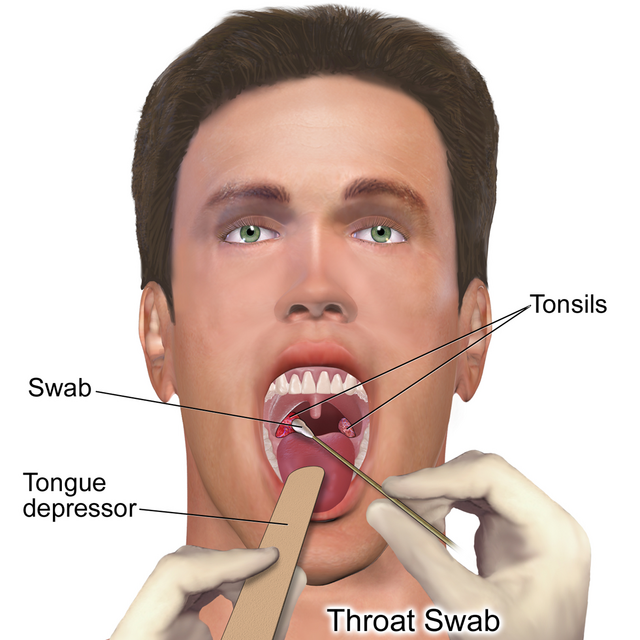 Illustration showing process and part of swabbing tonsils for a culture specimen