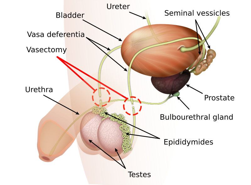 Illustration showing vasectomy site and major parts of male reproductive anatomy