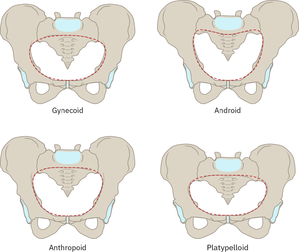 Illustration showing four different pelvis shapes