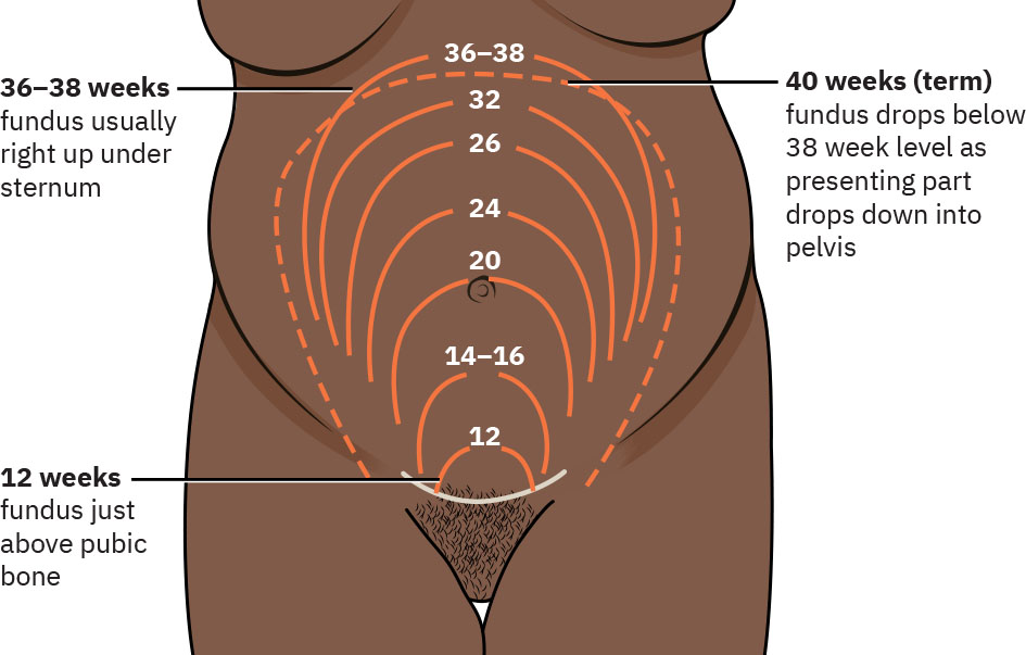 Illustration showing expected fundal heights for each stage of pregnancy