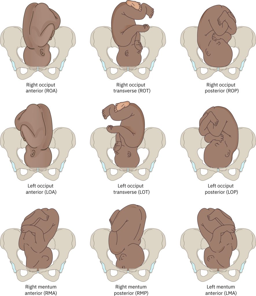 Illustration showing nine fetal postions