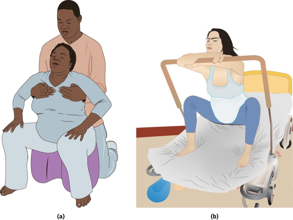 Illustration showing two different females using squatting positions during labor