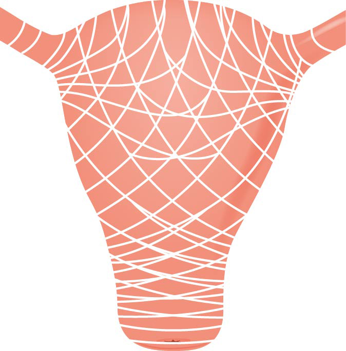 Illustration showing uterine muscles