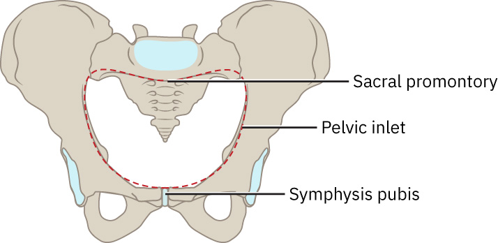 Illustration showing the pelvic inlet