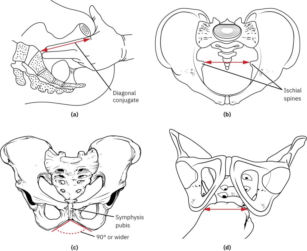 Illustrations showing the various measurement and locations for Clinical Pelvimetry