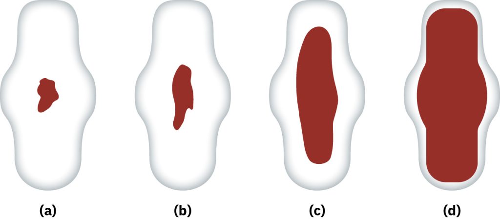 Illustration showing four Lochia Amounts