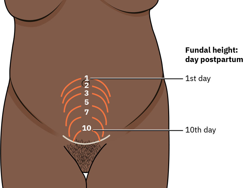 Illustration showing postpartum fundal heights