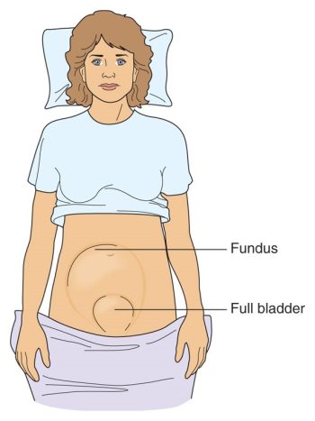 Illustration showing major observed structures during a bladder assessment