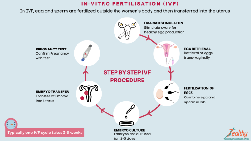 Infographic detailing the process of In Vitro Fertilization