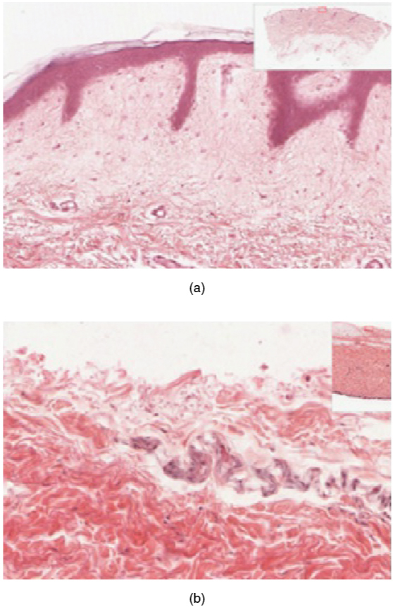 ”502ab_Thin_Skin_versus_Thick_Skin” by OpenStax College is licensed under CC BY 3.0 Images showing thin skin and thick skin