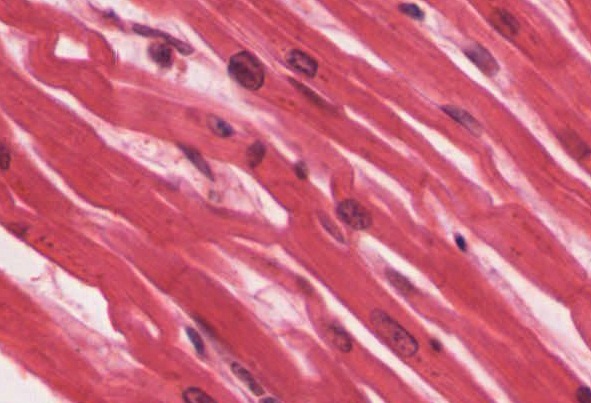 ”414c_Cardiacmuscle” by OpenStax College is licensed under CC BY 3.0 Cardiac muscle tissue