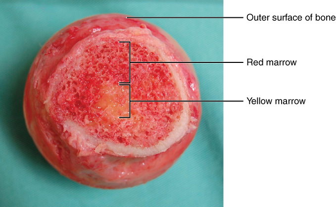 ”619_Red_and_Yellow_Bone_Marrow” by OpenStax College is licensed under CC BY 3.0 Head of femur with text to indicate outer surface of bone, as well as red and yellow marrow
