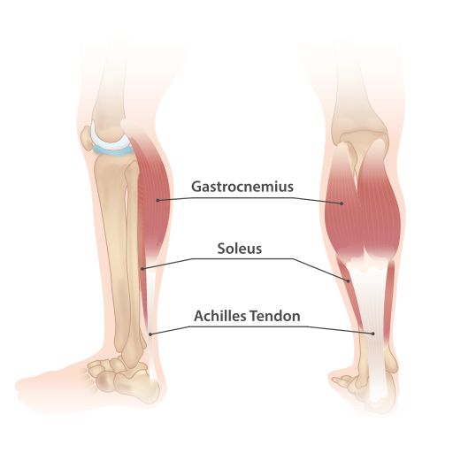 "Lower_leg_muscles" by InjuryMap is licensed under CC BY-SA 4.0 Illustration showing muscles in the lower leg