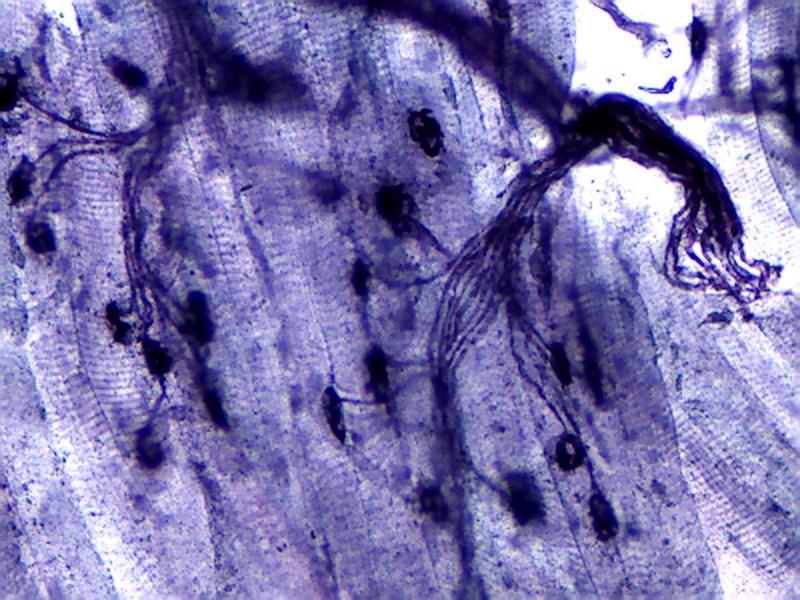 "运动终板" by Hlj55567516 is licensed under CC BY-SA 3.0 Microscopic view of neuromuscular junction